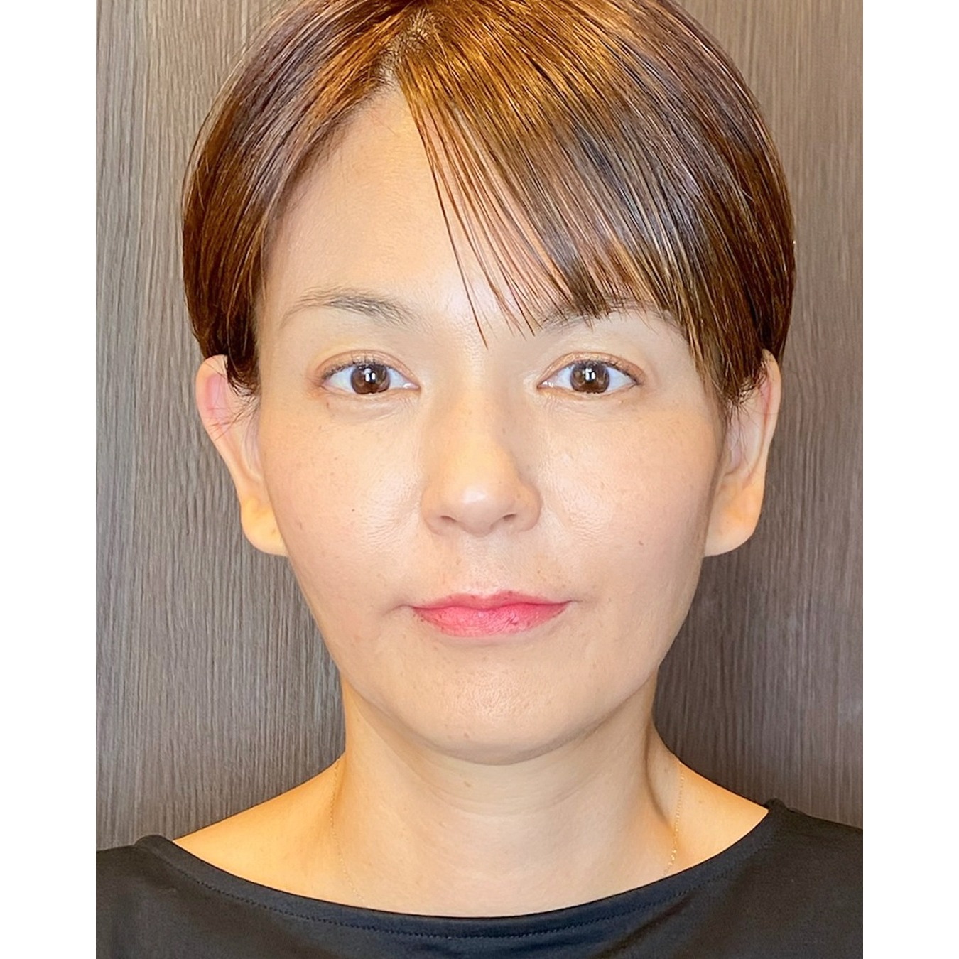 リップ After